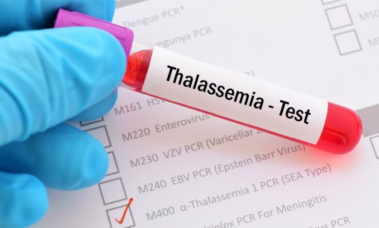 وزارة الصحة تطلق إجراءات جديدة لمنع الثلاسيميا وتشدد على فحوصات قبل الزواج