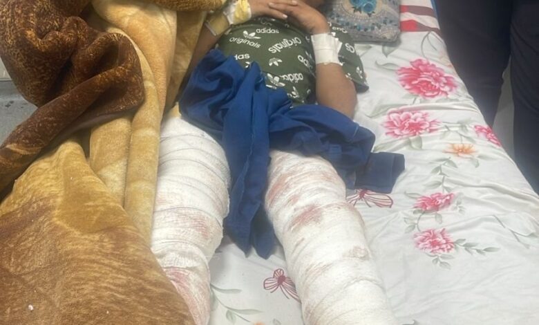 وزارة الصحة تعلن نجاح معالجة الطفل المصاب في حادثة نمر الزوراء